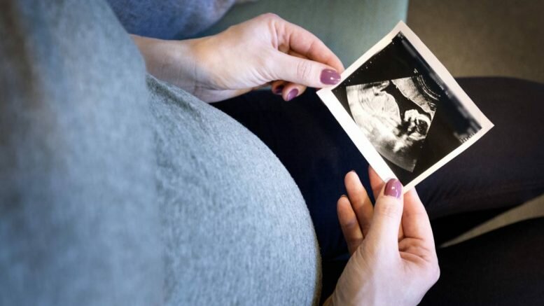 Ultrasound pregnant