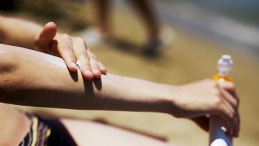 The risk of cancerous mole is increased for man with overweight