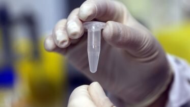Multiple lung cancer patients receive successful curative treatment
