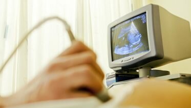 Norway has fewest number of teenage abortions in the Nordic countries