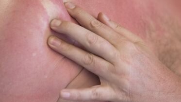 We have set an UV record in May – notice of still very high radiation