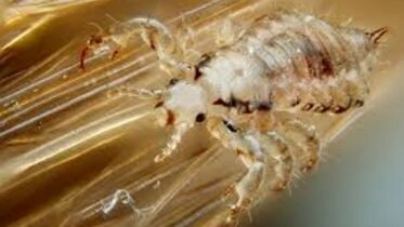 Ready for another season with head lice