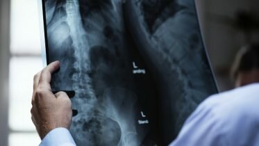 Over 2,200 investigations need to be reviewed again after radiologists overlook serious mistakes