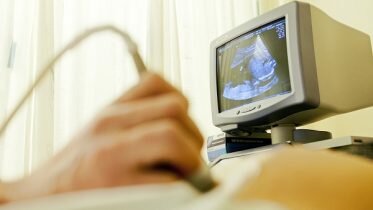 Historical low abortion figures in Norway