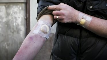 Hepatitis C will be eradicated as a public health problem in Norway
