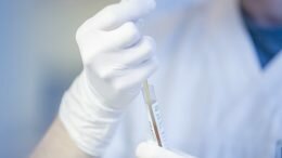 Tester samples for corona antibodies